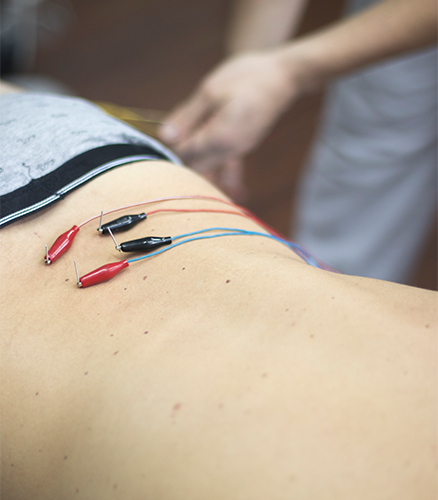 Electroacupuncture needles with small clips attached along person’s calf muscle