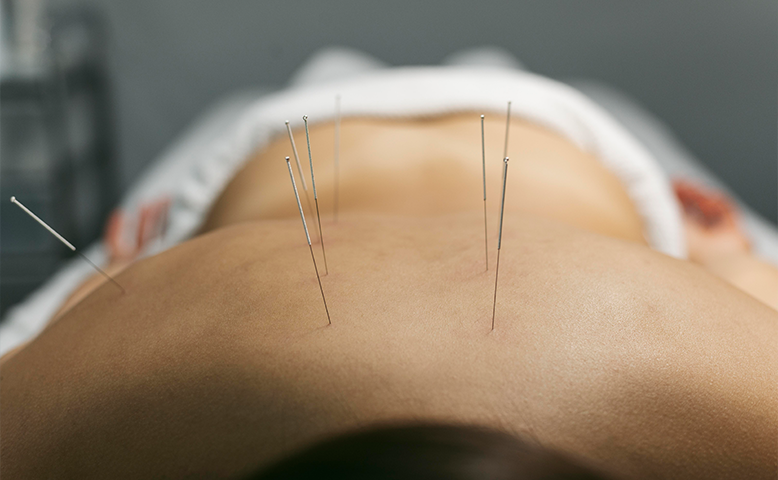 When Pain Pills Stop Working: A Real Look at Acupuncture for Chronic Pain